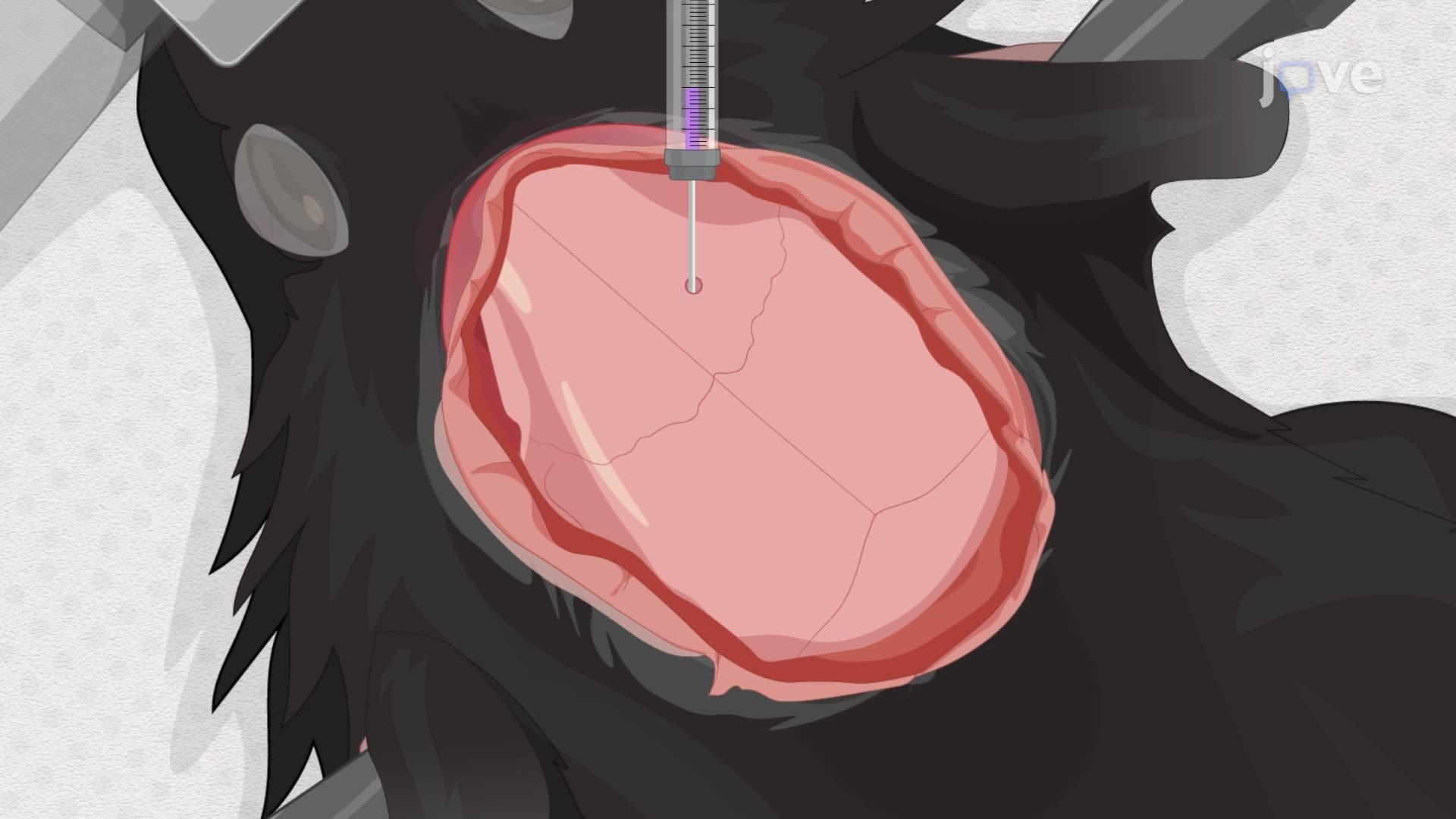 Transplantation of Human Neural Progenitor Cells in the Mouse Brain