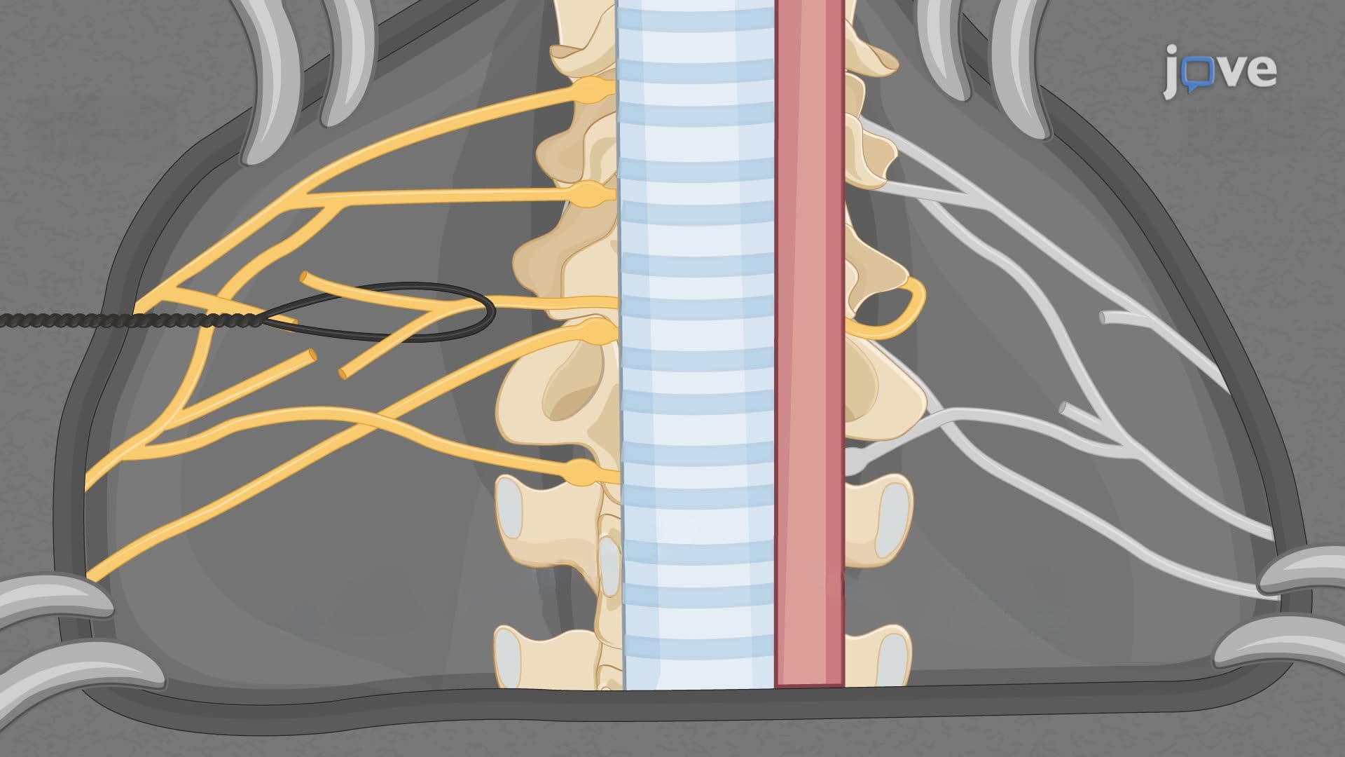 Direct Reconnection of Cervical Nerves to Restore Forelimb Mobility in a Mouse