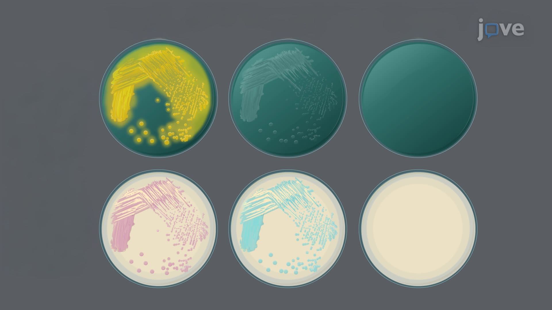 A New Chromogenic Medium for Rapid Detection of Vibrio Species
