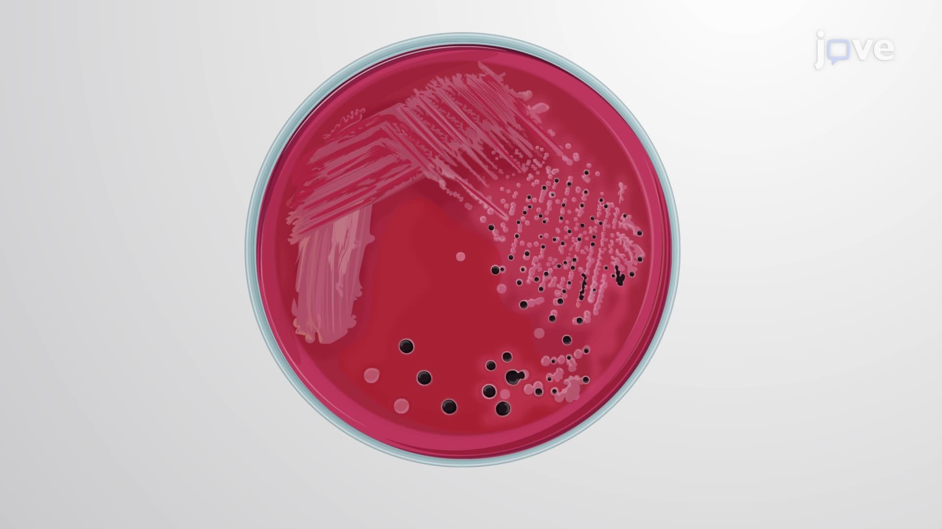 Selective Enrichment and Identification of Salmonella spp. Using Xylose Lysine Deoxycholate and Chromogenic Agar