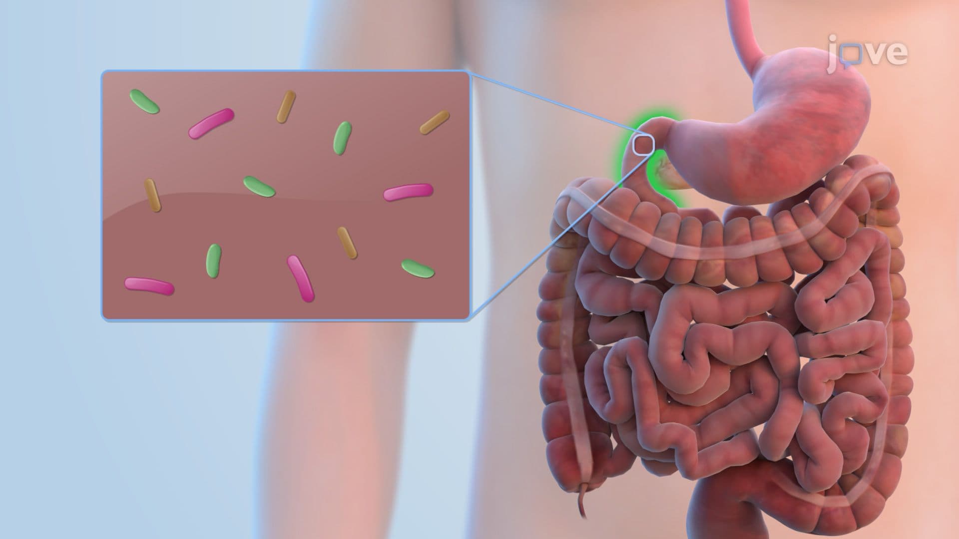 Microbiota of the Stomach and Small Intestine
