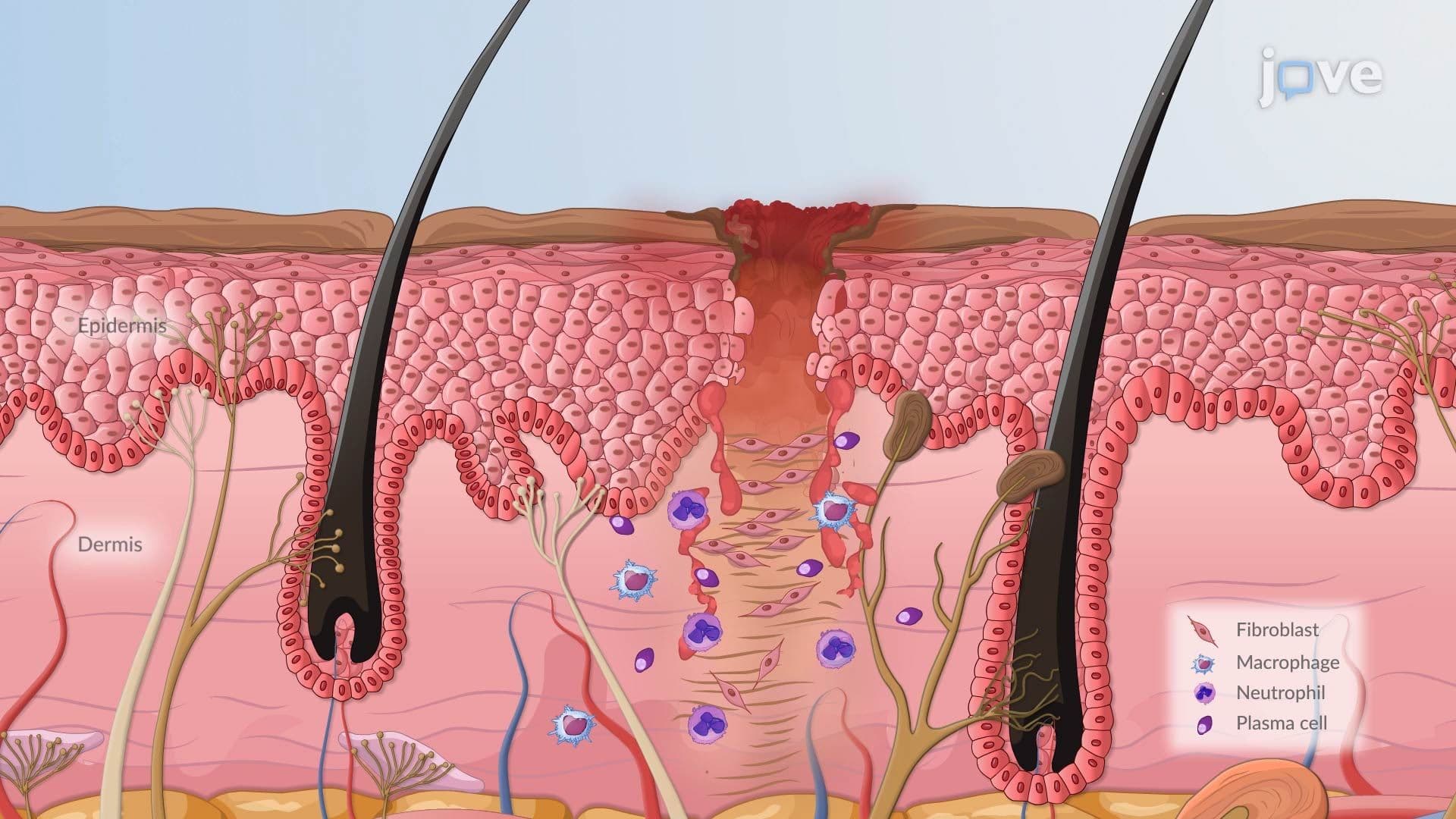 Cellular Adaptation III: Hyperplasia