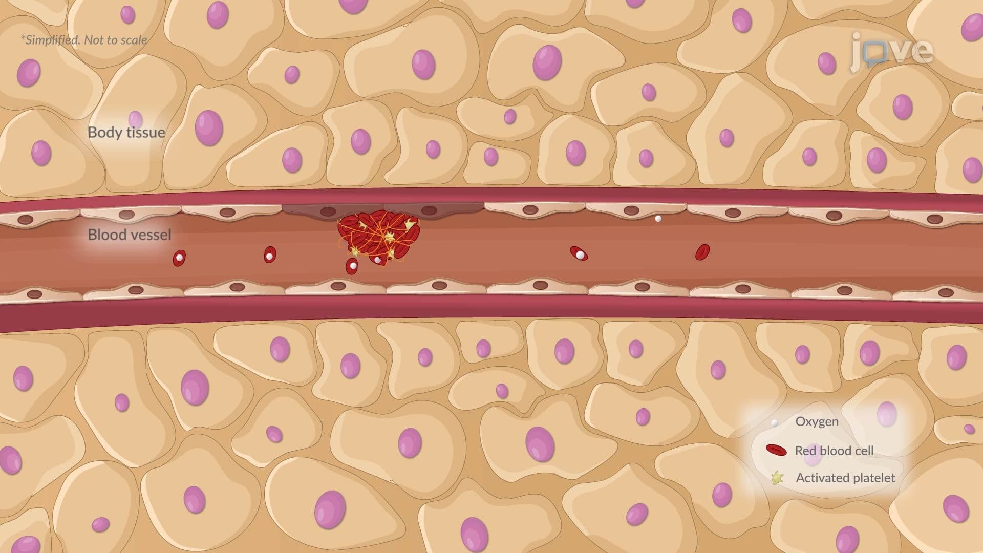 Cellular Injury II: Classification