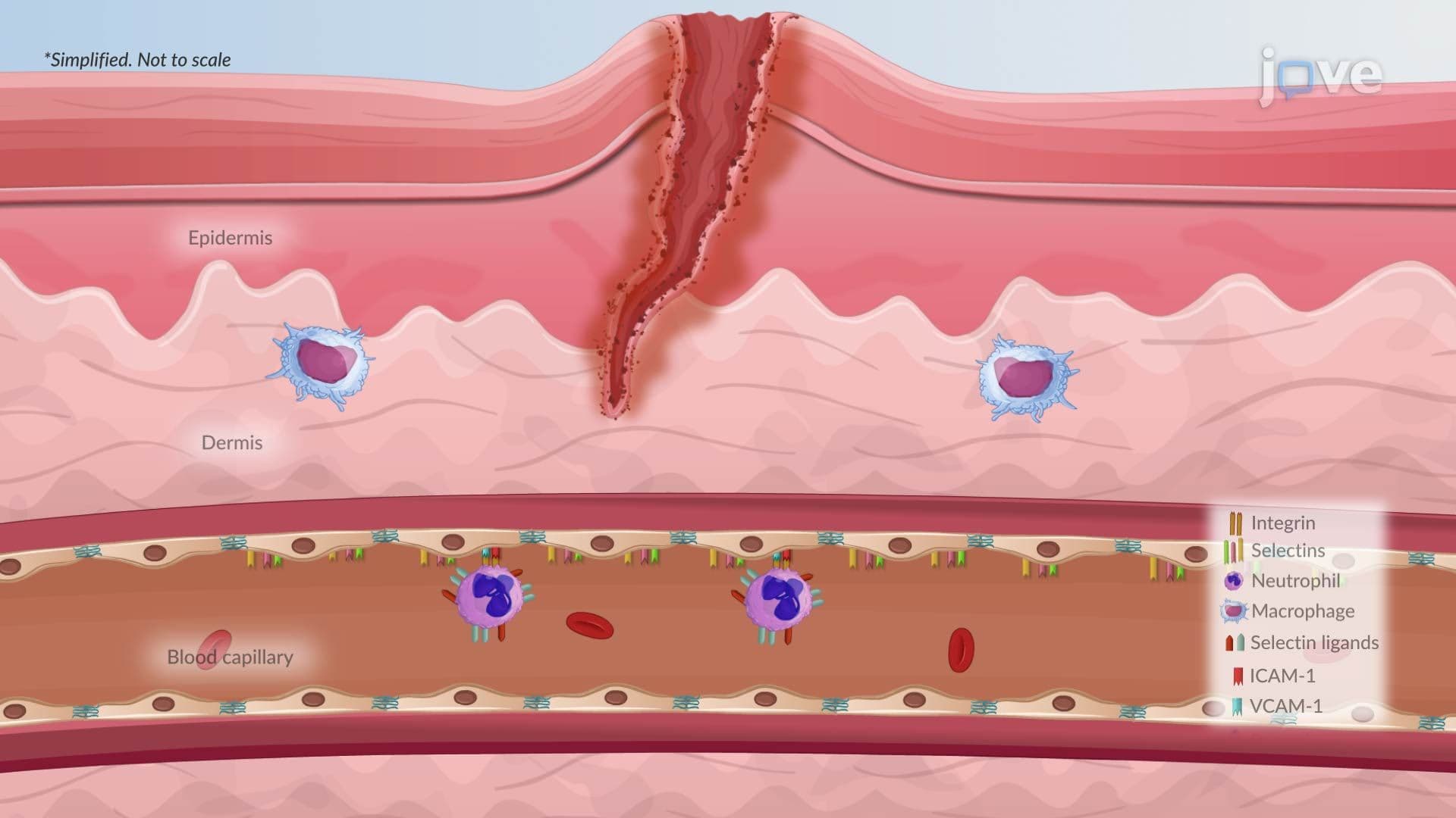 Acute Inflammation II: Cellular Phase