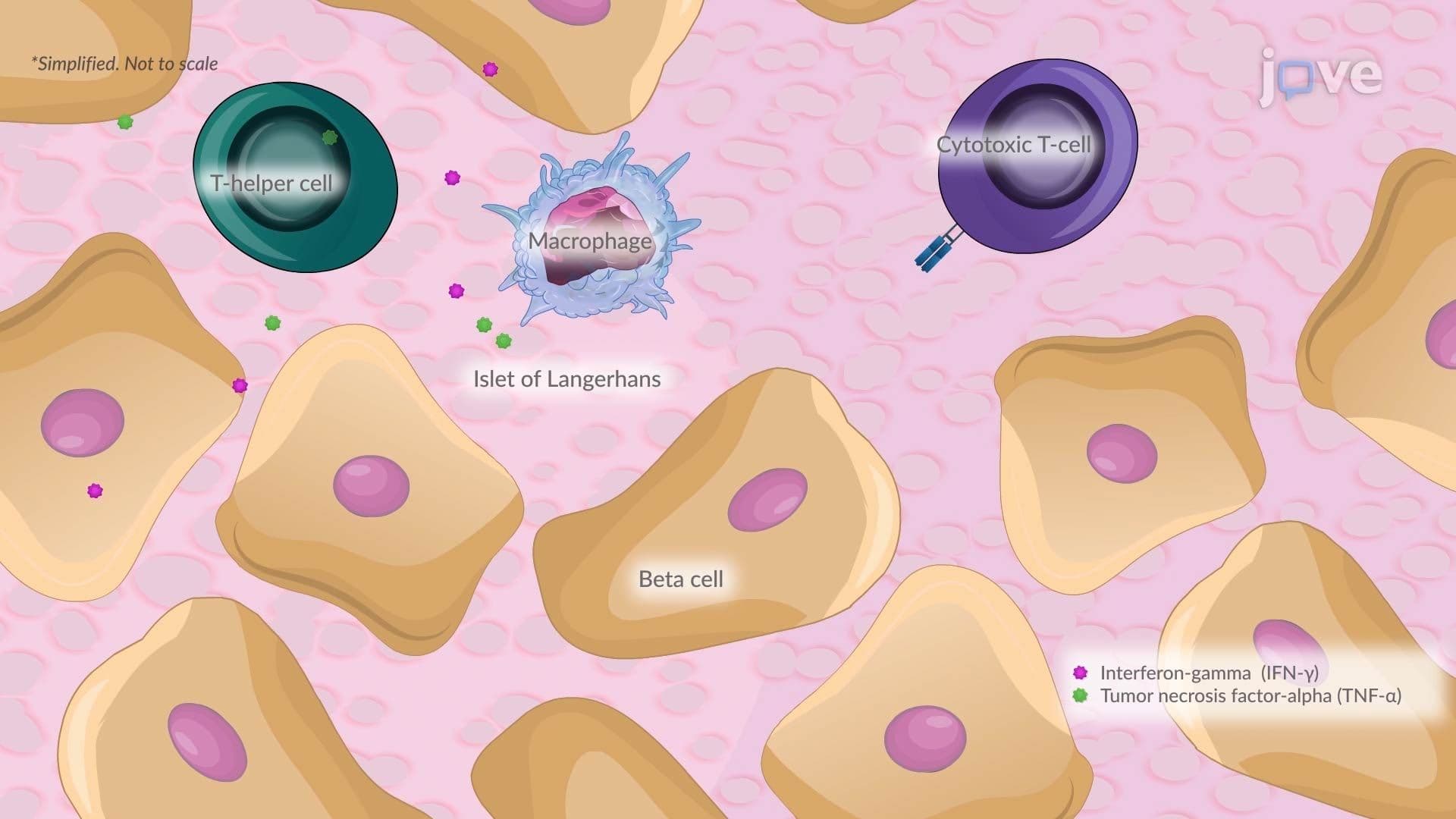 Type I Diabetes II: Pathophysiology