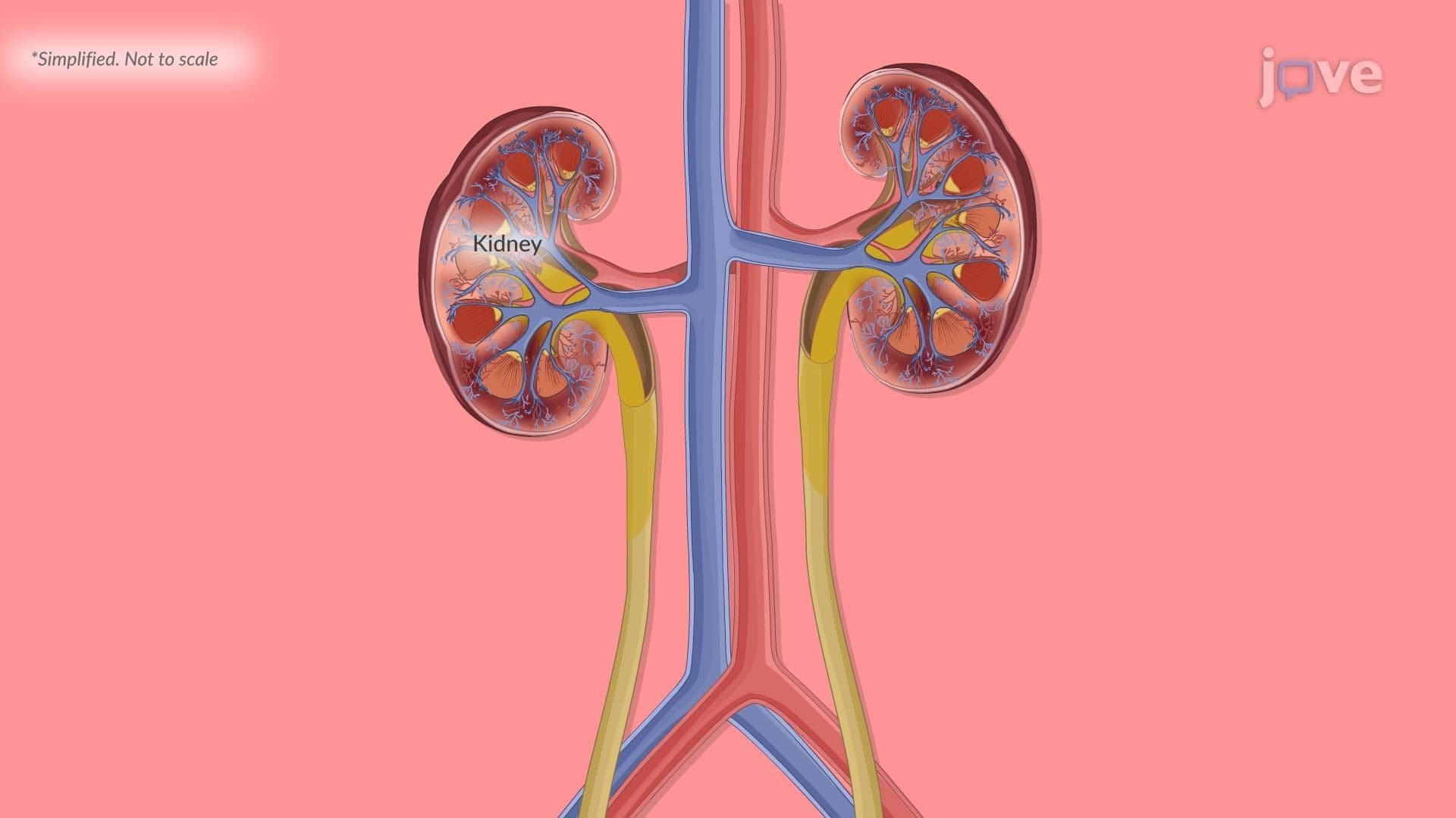 Type I Diabetes III: Clinical Manifestations