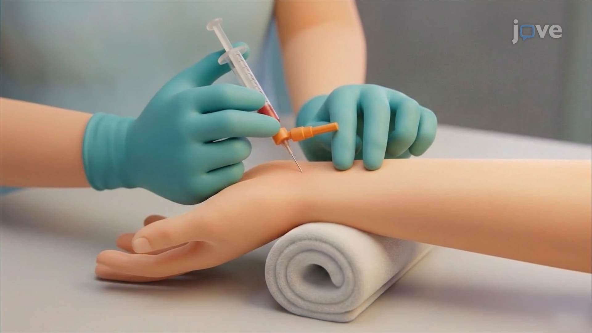 Diabetic Ketoacidosis l: Introduction