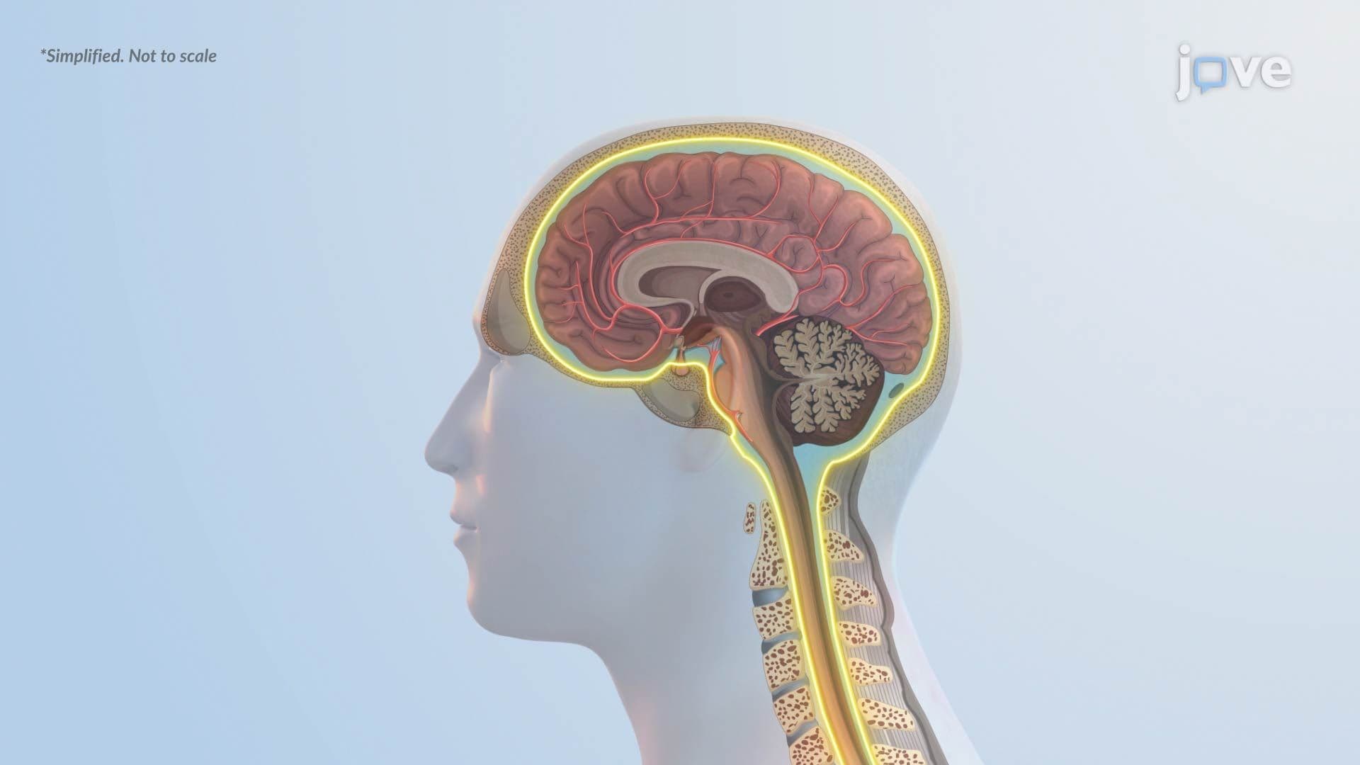 Increased Intracranial Pressure l: Introduction