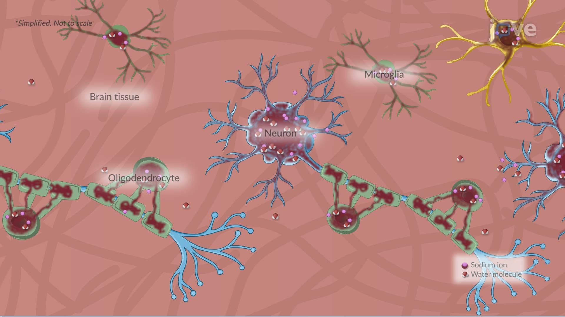 Cerebral Edema l: Introduction