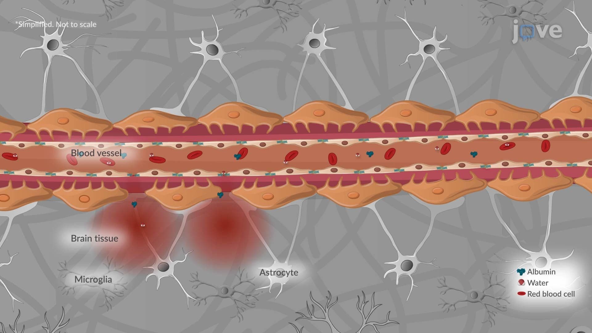Cerebral Edema ll: Pathophysiology