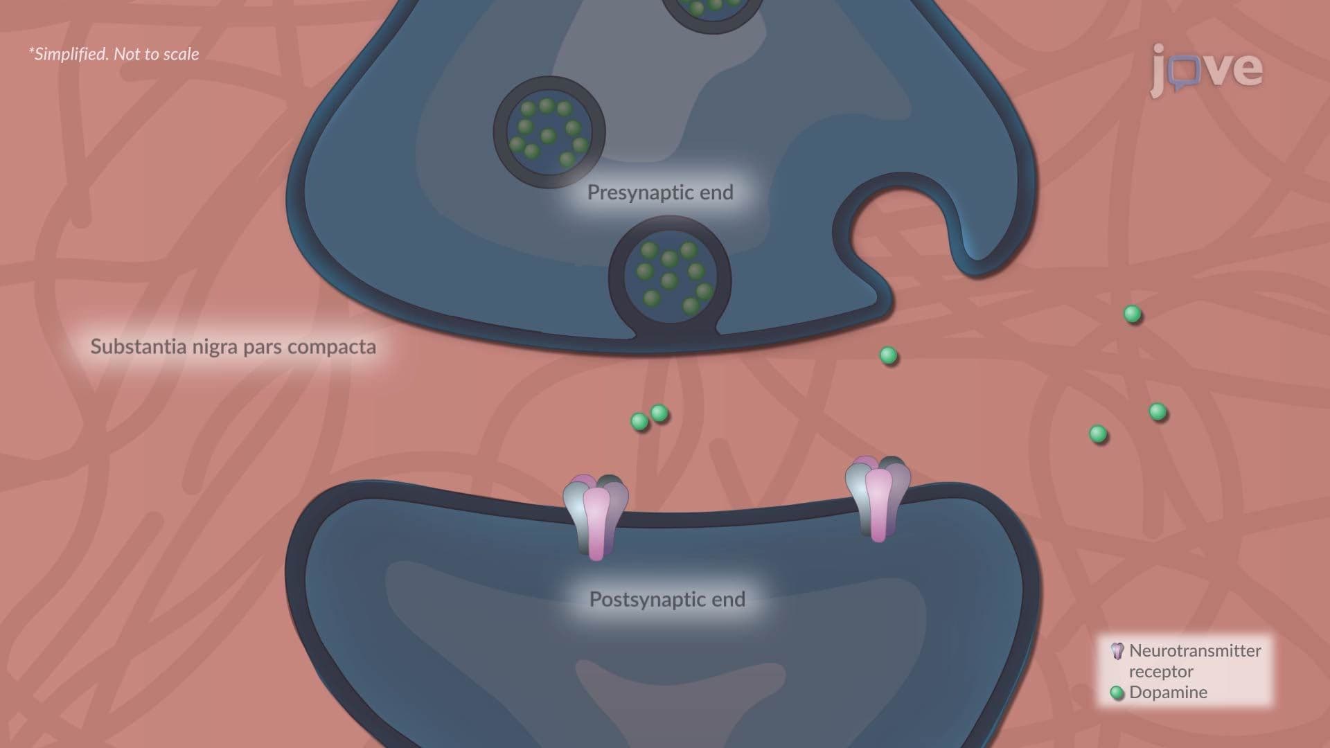 Parkinson Disease l: Introduction