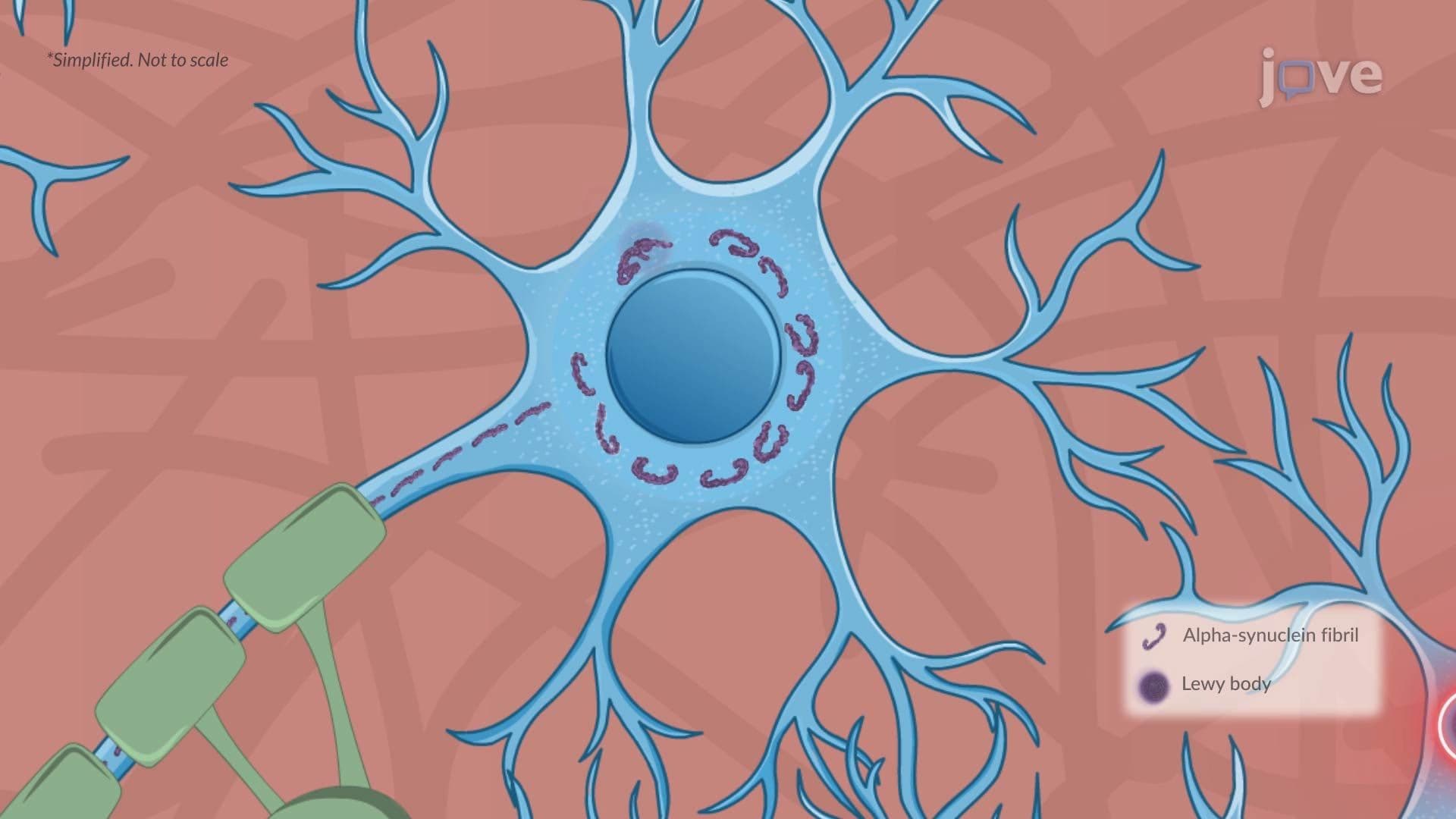 Parkinson Disease ll: Pathophysiology