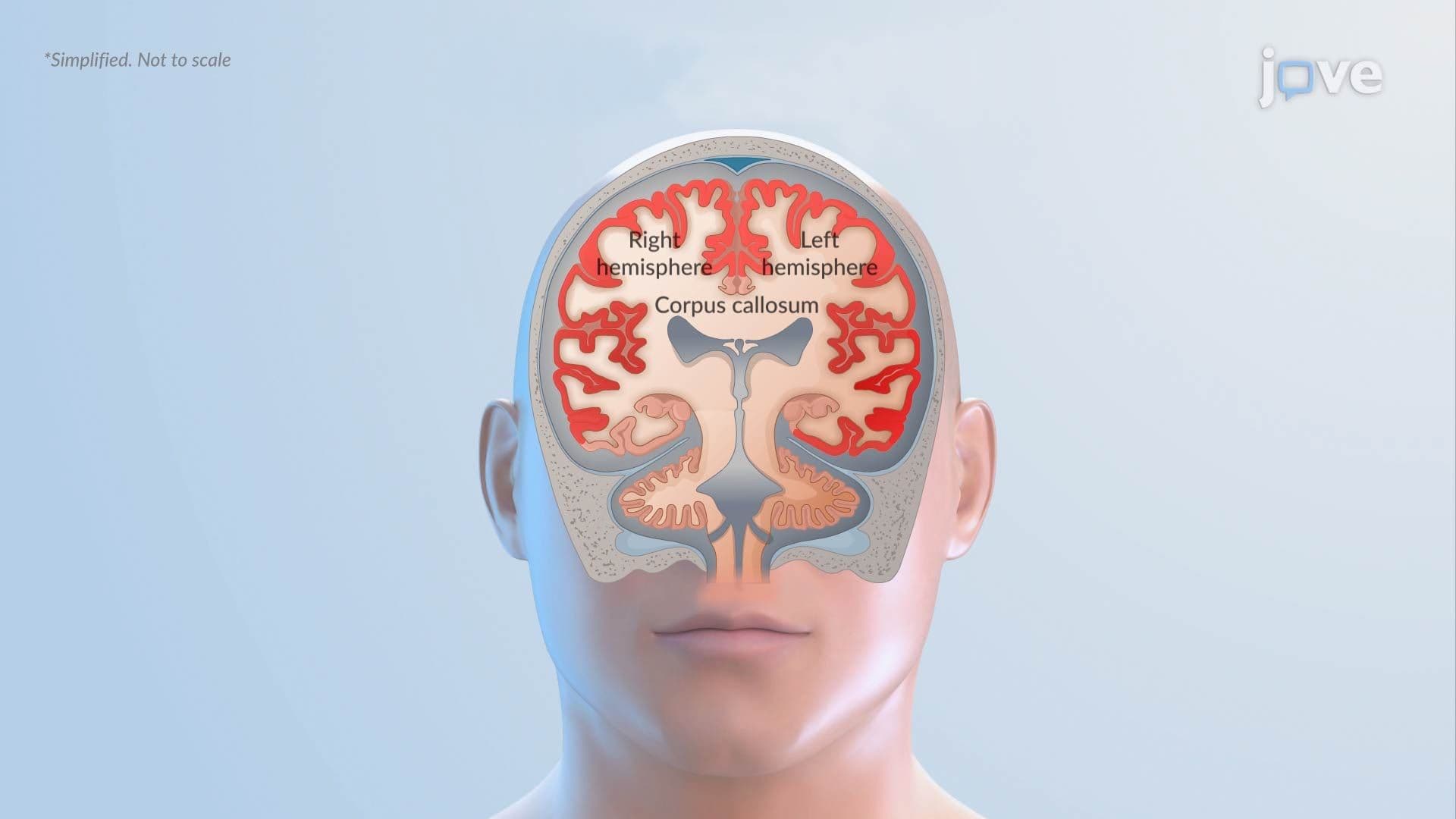 Seizures ll: Types