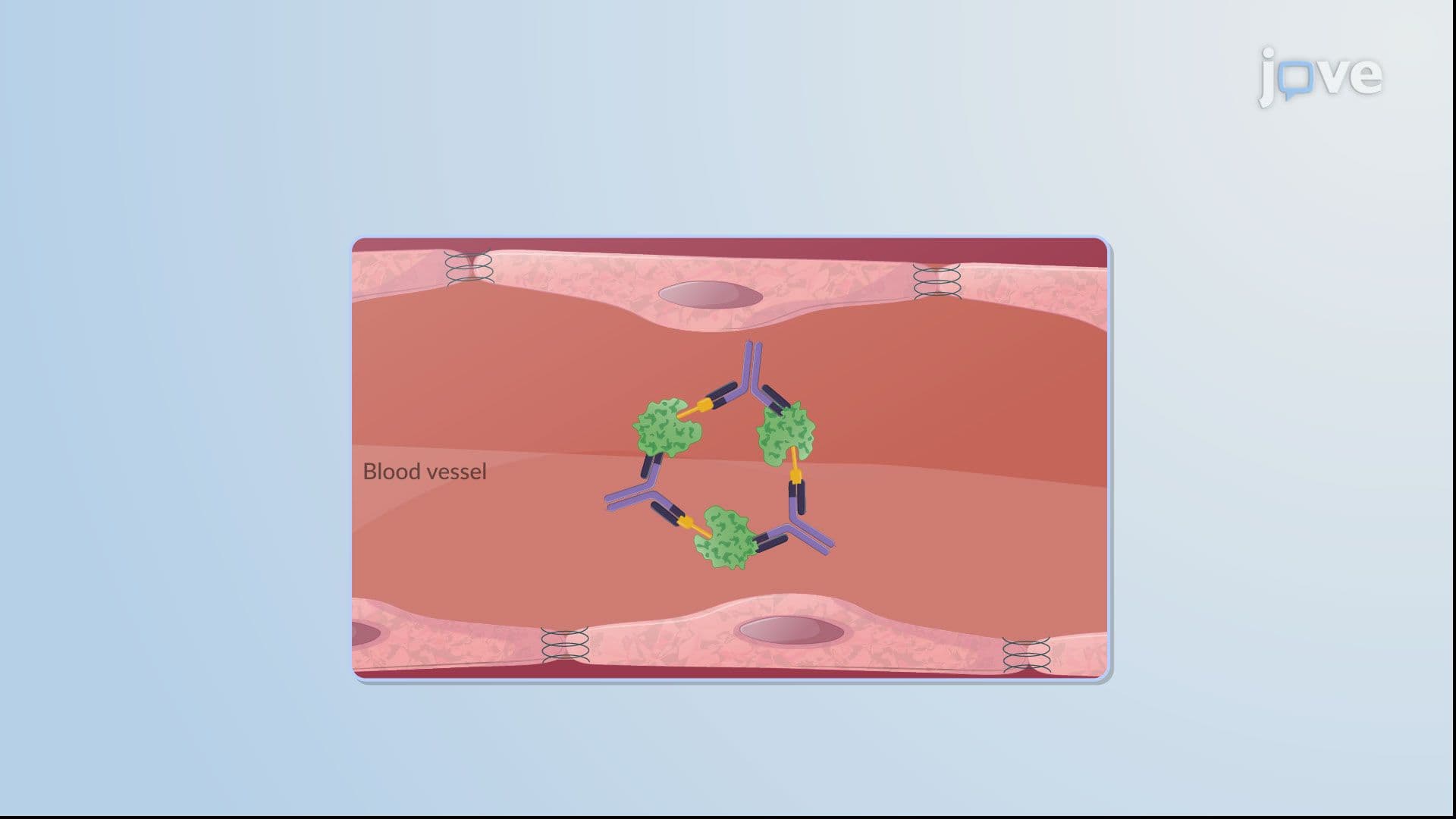 Hypersensitivity Reactions: Immune-Complex Reactions