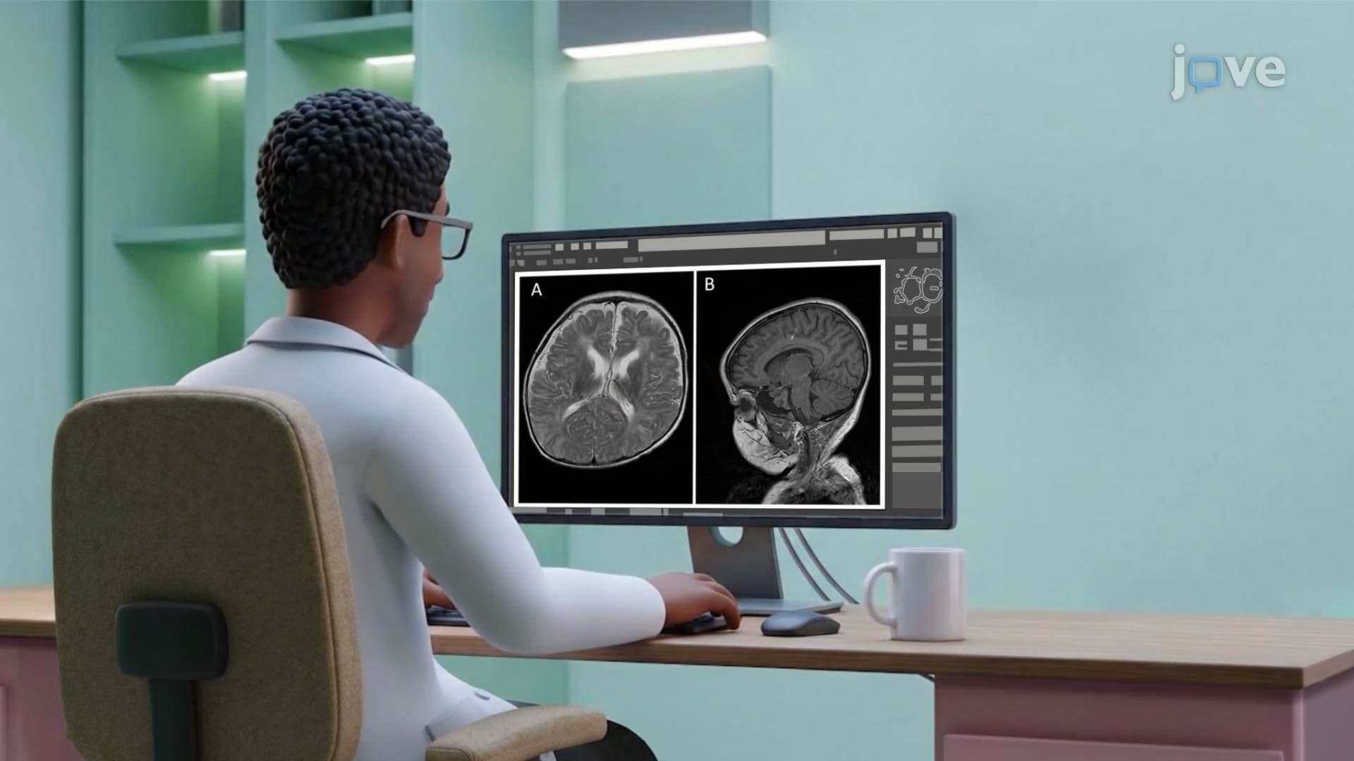 Cognitive Neuroscience Approach