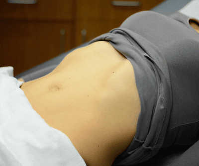 Abdominal Exam I: Inspection and Auscultation