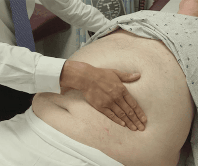 Palpation