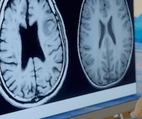 The Split Brain