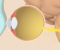 Finding Your Blind Spot and Perceptual Filling-in