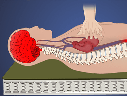Basic Life Support: Cardiopulmonary Resuscitation and Defibrillation