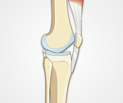 Knee Exam