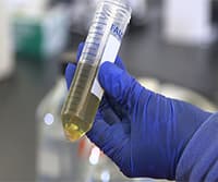Community DNA Extraction from Bacterial Colonies