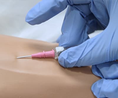 Peripheral Intravenous Catheter Insertion