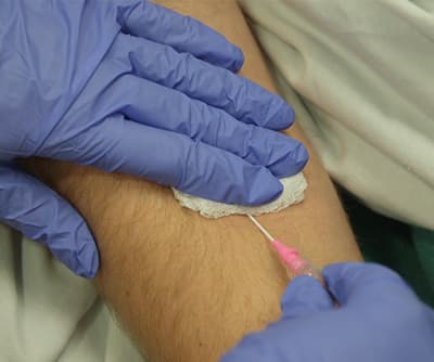 Discontinuing Intravenous Fluids and a Peripheral Intravenous Line