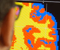 Measuring Grey Matter Differences with Voxel-based Morphometry: The Musical Brain