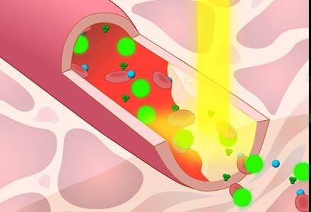 Photoacoustic Tomography to Image Blood and Lipids in the Infrarenal Aorta