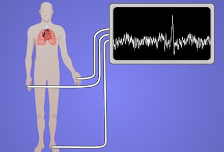 Acquisition and Analysis of an ECG (electrocardiography) Signal