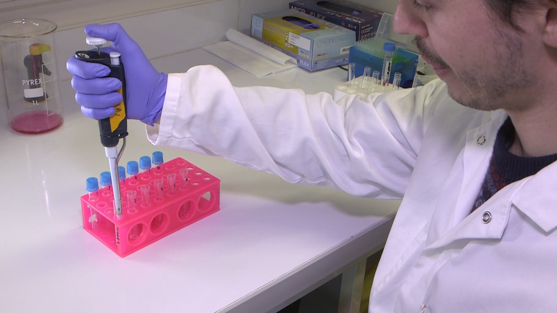 Flow Cytometry and Fluorescence-Activated Cell Sorting (FACS): Isolation of Splenic B Lymphocytes