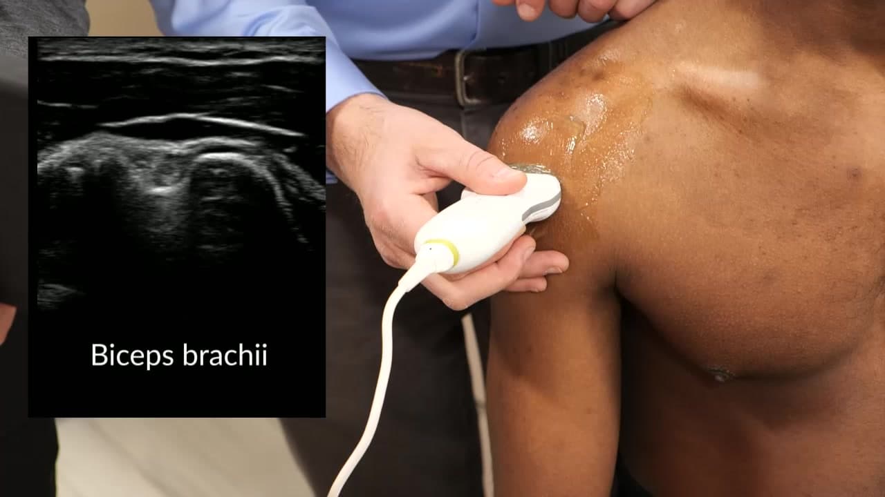Using Point of Care Ultrasound to Augment Acquisition of Physical Exam Skills: Knee and Shoulder