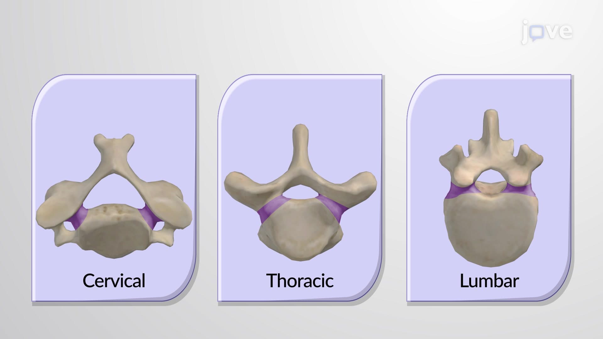 General Structure of a Vertebra