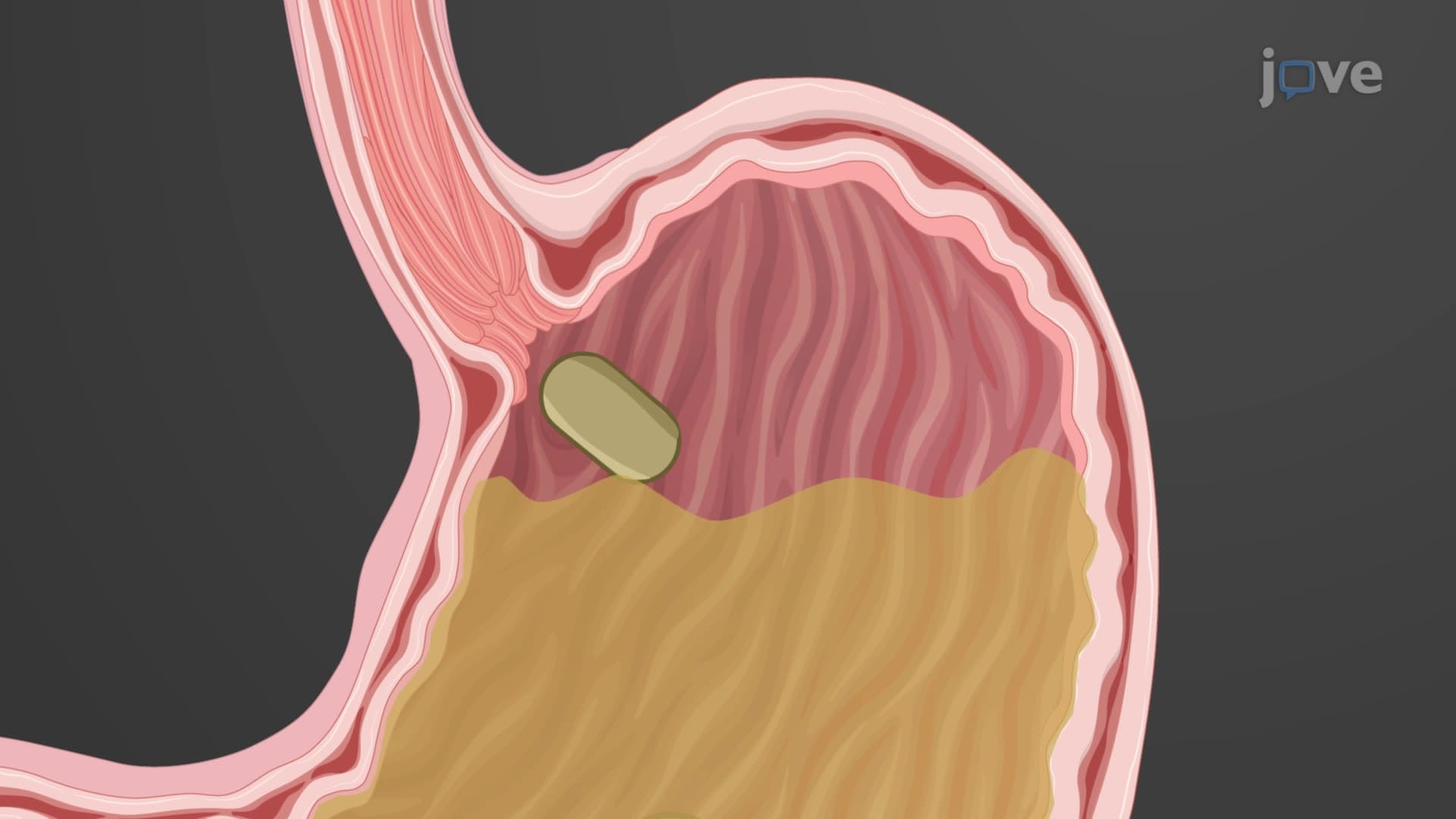 Gastric Motility