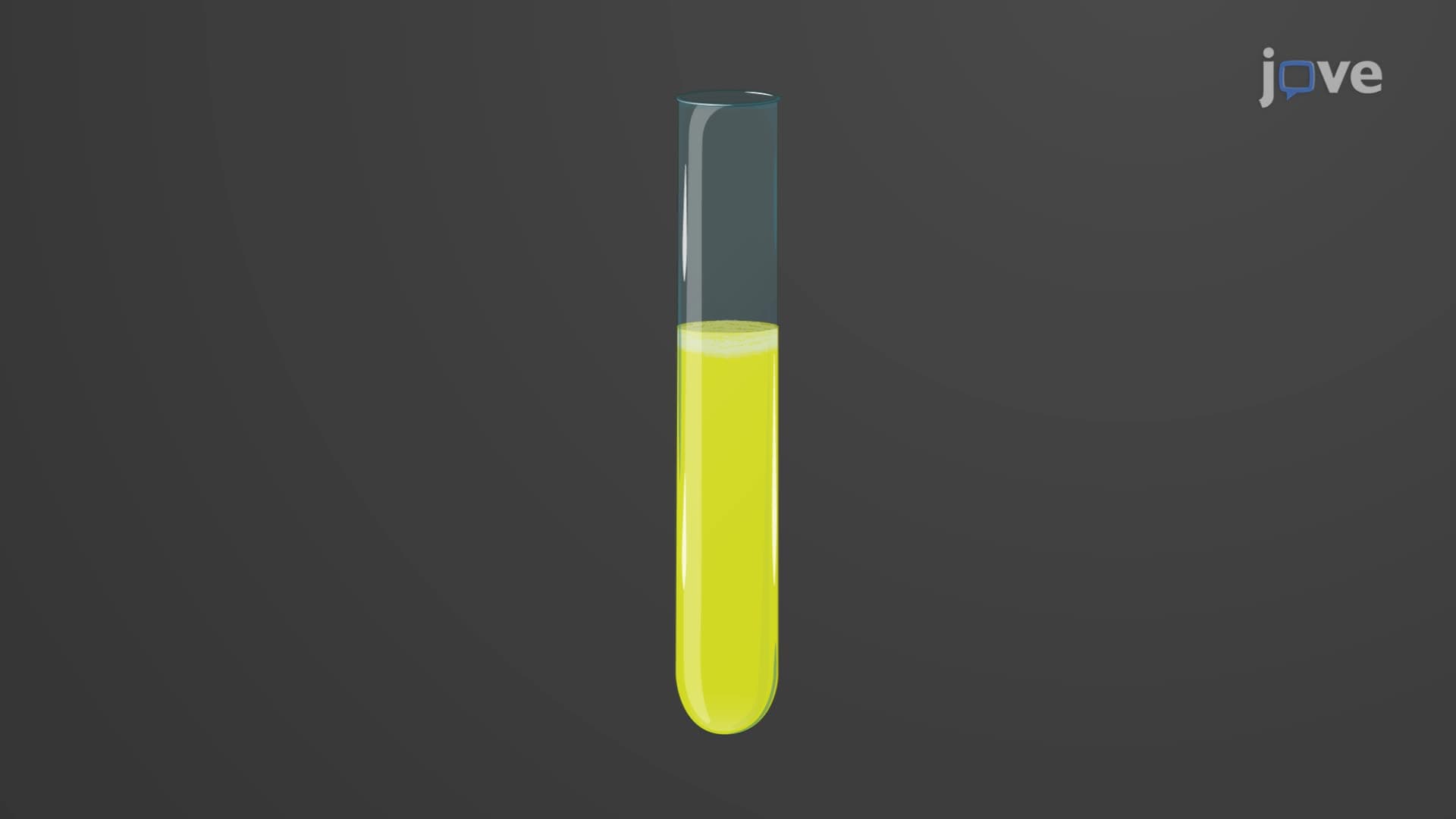 Urine: Physical and Chemical Properties
