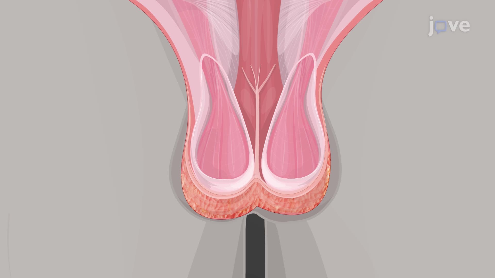 Testes: Gross Anatomy
