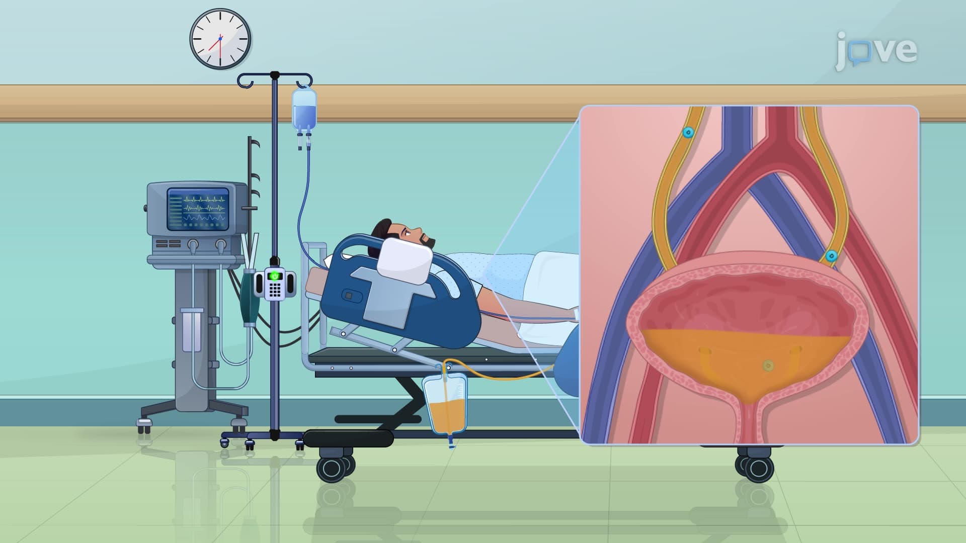 Renal Drug Excretion: Effect of Urine pH, Flow Rate, and Drug pKa