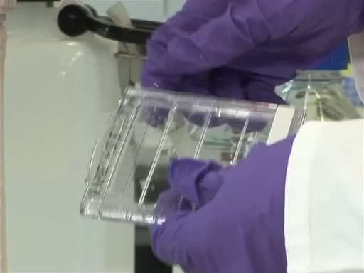 Separating Protein with SDS-PAGE