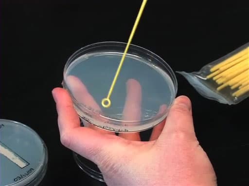 Yeast Maintenance