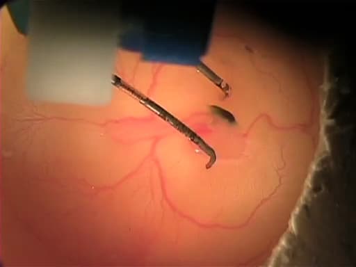 In ovo Electroporation of Chicken Embryos