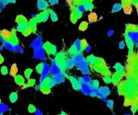 Calcium Imaging in Neurons
