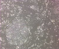 Embryonic Stem Cell Culture and Differentiation