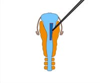 Transplantation Studies
