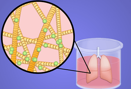 Overview of Tissue Engineering