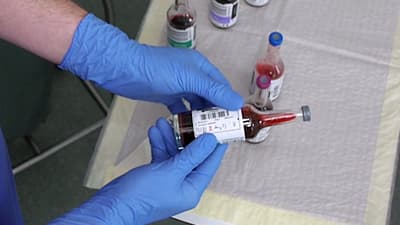 COVID-19 / Coronavirus Outbreak: How to take blood cultures