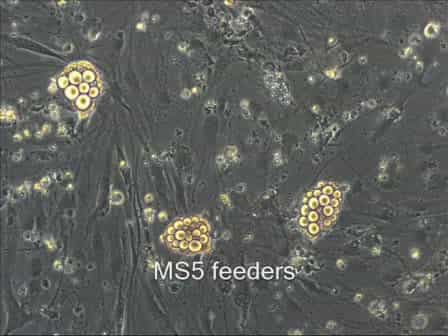 ES Cell-derived Neuroepithelial Cell Cultures