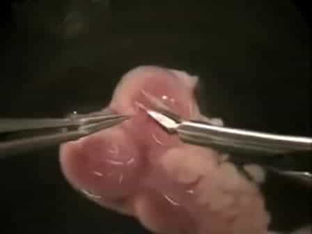 Mouse Dorsal Forebrain Explant Isolation