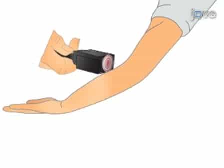 An Experimental Paradigm for the Prediction of Post-Operative Pain (PPOP)