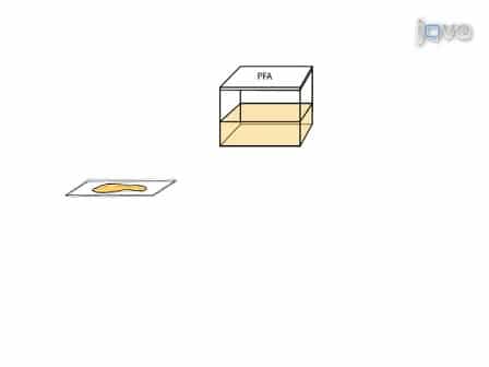 In situ Quantification of Pancreatic Beta-cell Mass in Mice